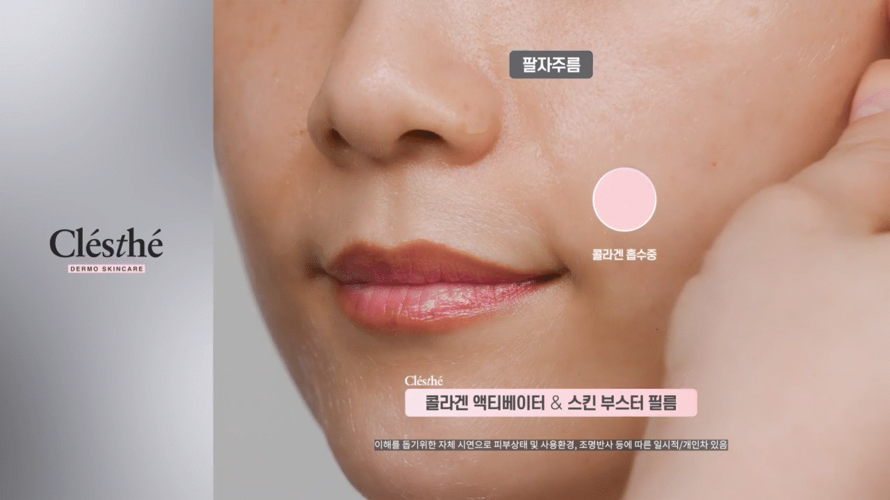 TalkFile_팔자주름.gif